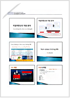 Non-cross linking HA